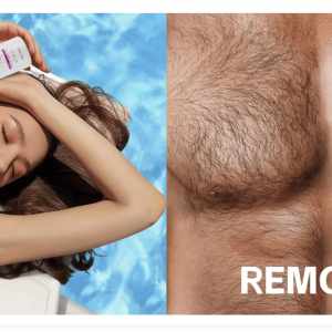 Hair Removal